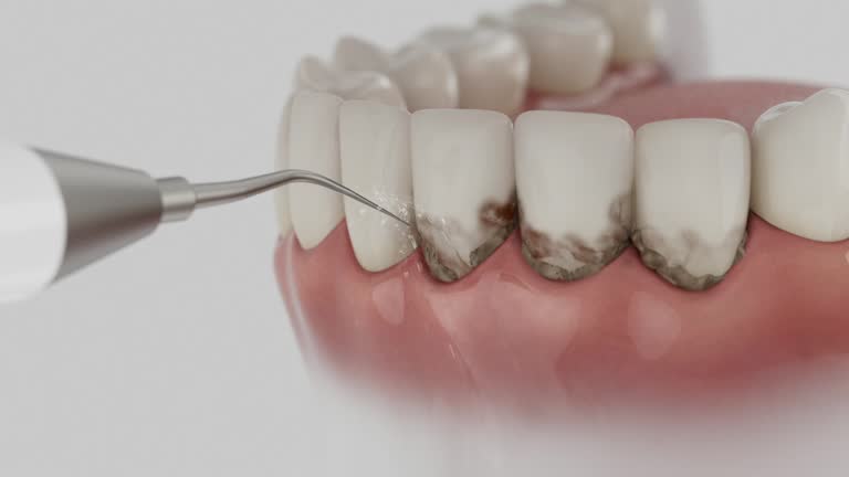 Reliable Wisdom Tooth Removal contractor in Teton County County, WY by Dentist Open Now